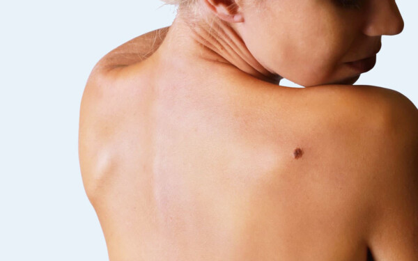une femme qui regarde un grain de beauté dans son dos