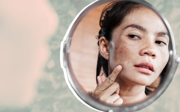 La consommation de ces aliments peut réduire la pigmentation de la peau